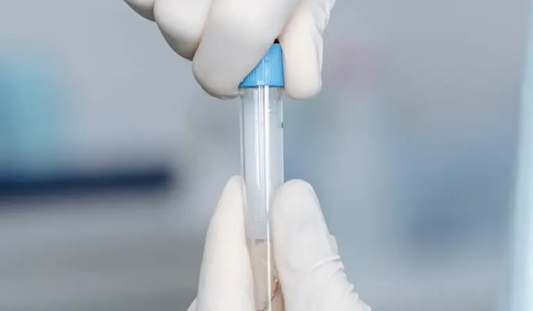 Gloved hands handling a test tube with a blue cap during water quality testing in a laboratory setting.