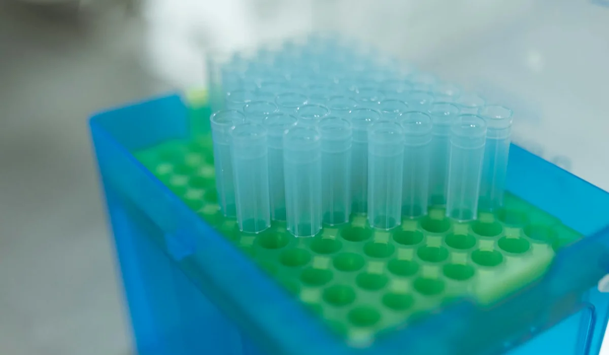 Blue laboratory rack with multiple clear test tubes standing in a green tray, used for water testing in aquariums.