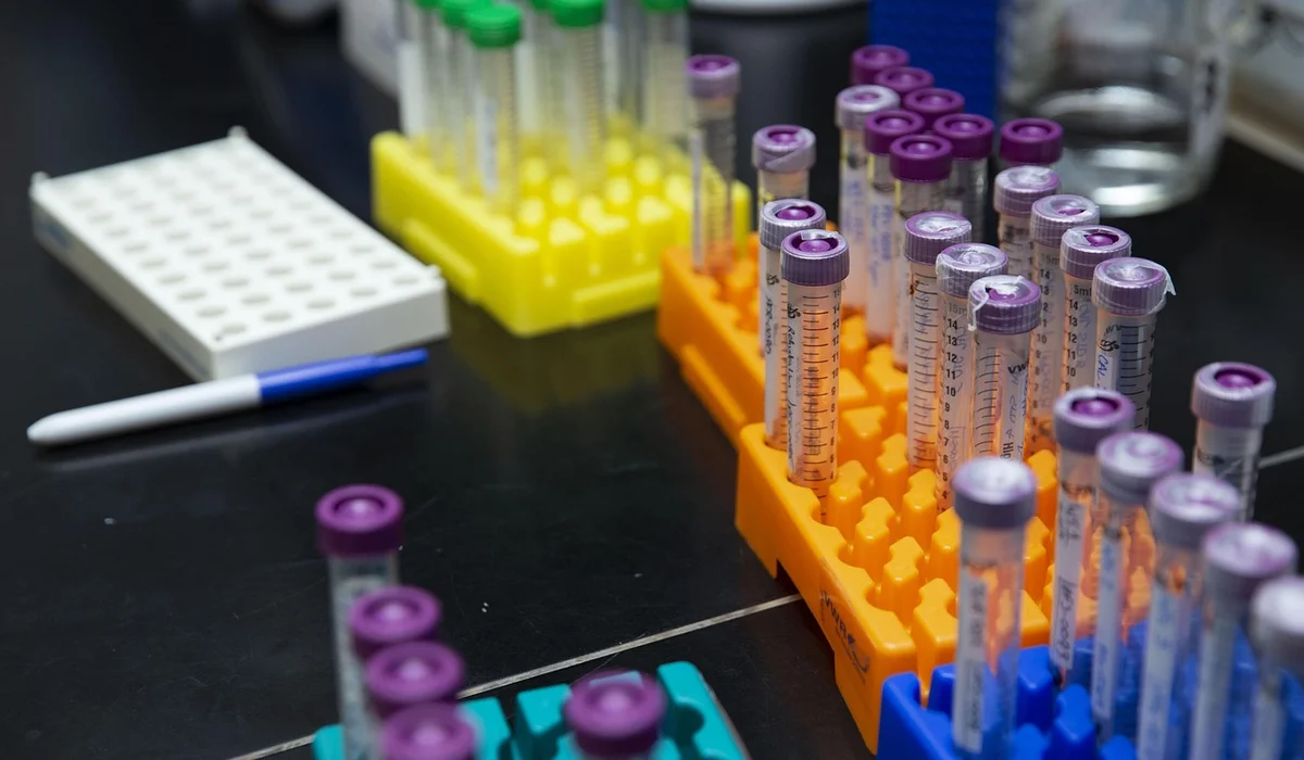 Laboratory bench with test tubes in racks and a pipette, illustrating water quality monitoring for aquarium biofilm prevention.