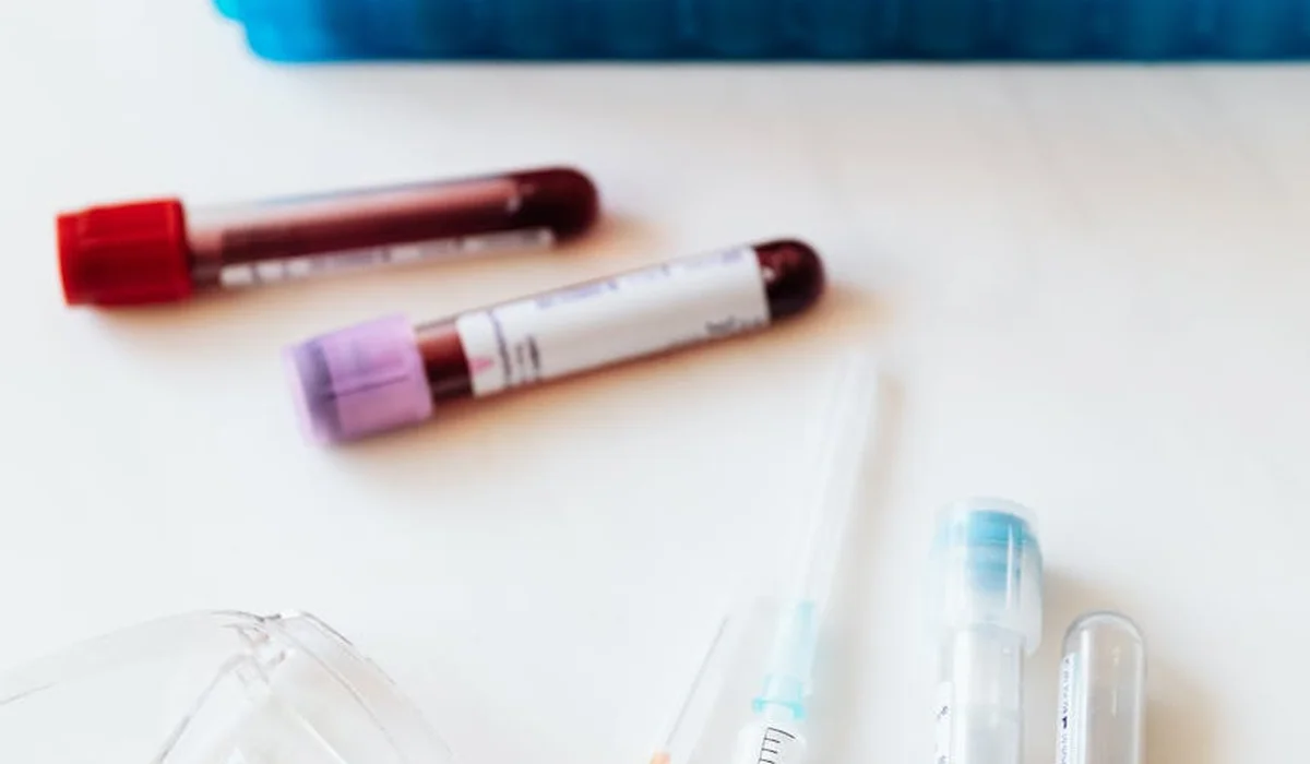 Lab-style aquarium testing tools, including test tubes and syringes, arranged on a white surface.