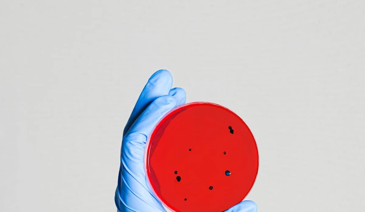 Gloved hand holding a red petri dish with small black bacterial colonies